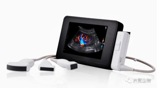 KiviSonic ®全新一代彩色多普勒超声诊断仪MIPO8获批